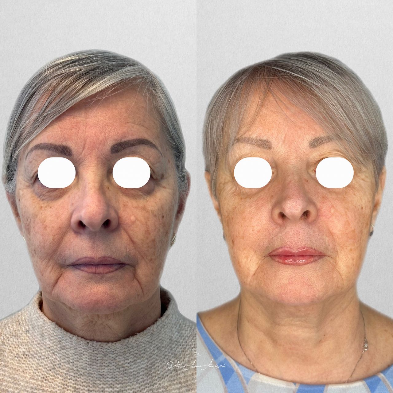 Assmaà Abu Higileh-6