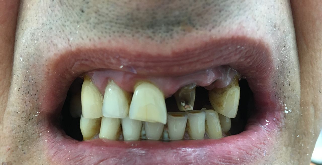 Luigi Aiardo Esposito-1