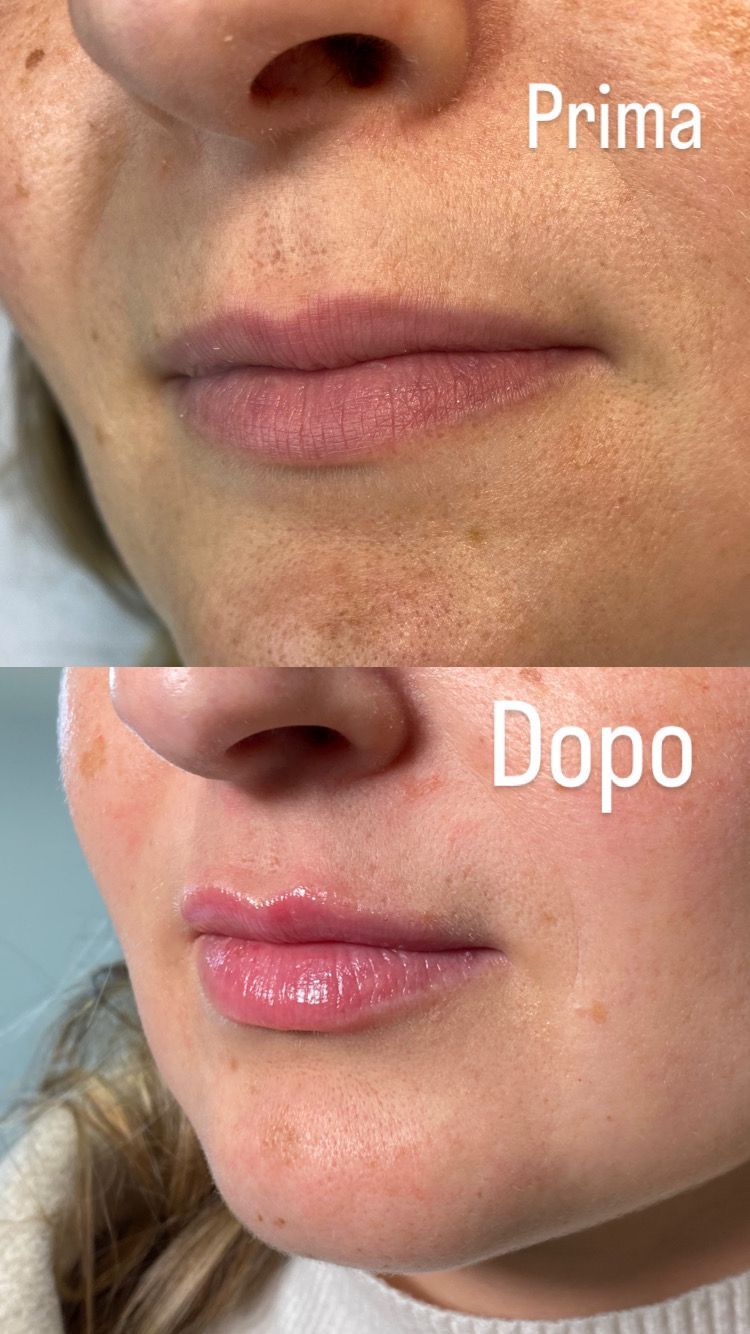 Alberto Alessandri-18