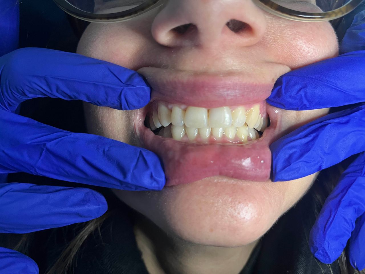 Riunito Dentista Dentalpar-14