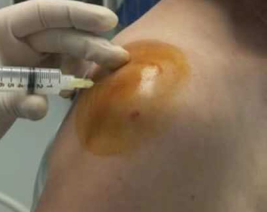 Carmine Del Gaìzo-3