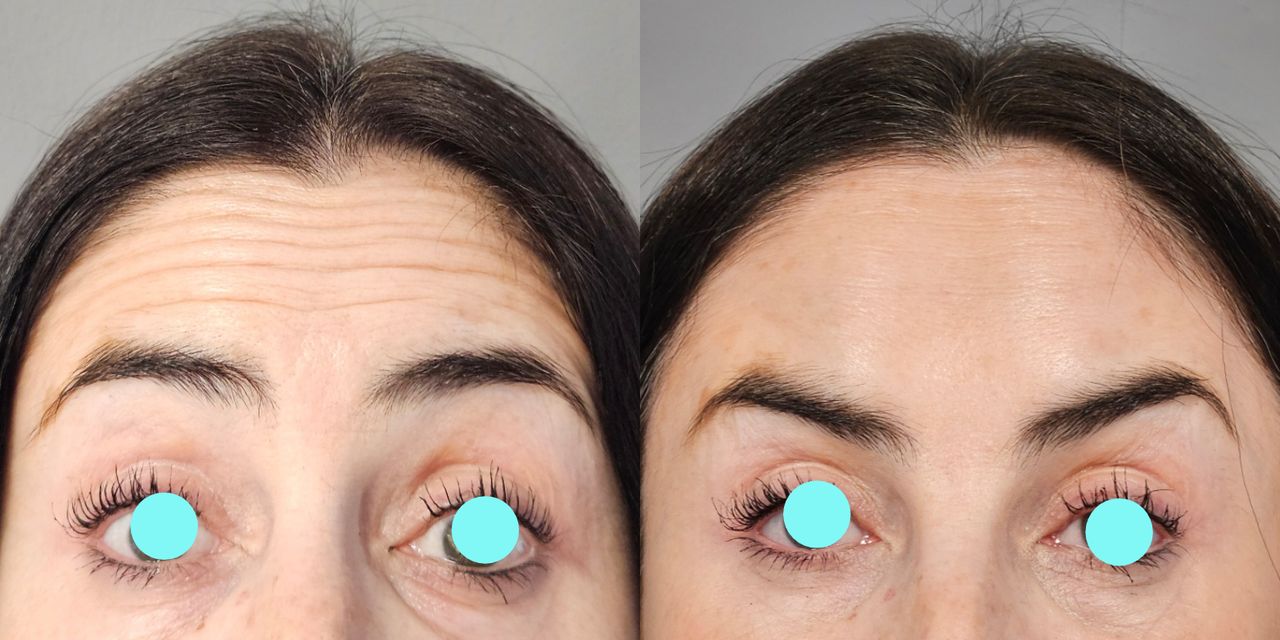 Rosalba Herrero Zerpa-442