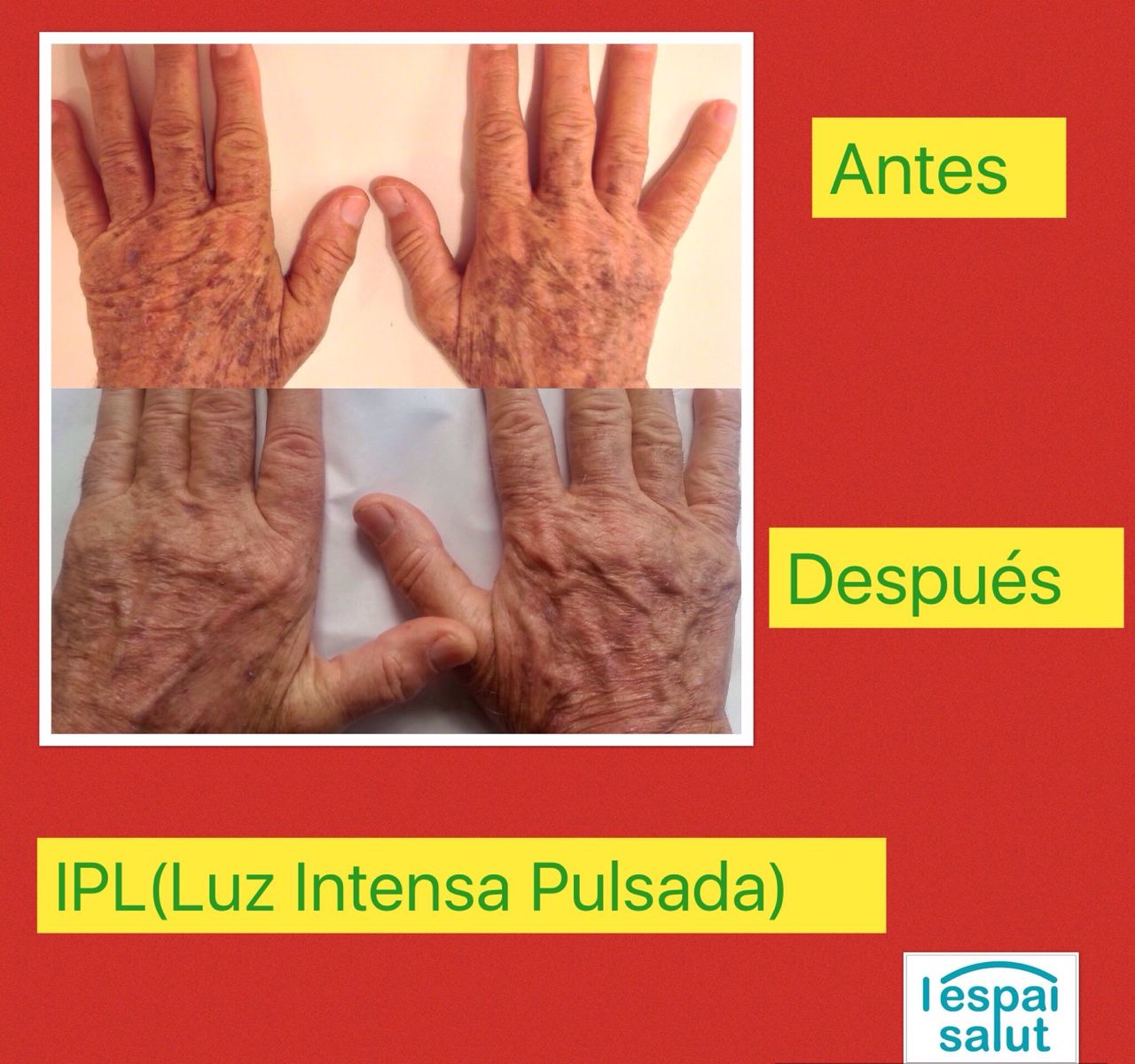 Rosalba Herrero Zerpa-406