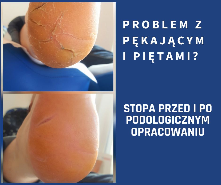 Aleksandra Talarek-1