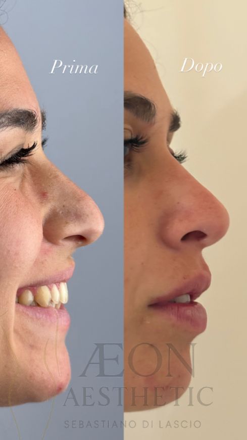 Sebastiano Di Lascio-4