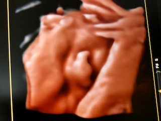 Domenico D'assisi-15