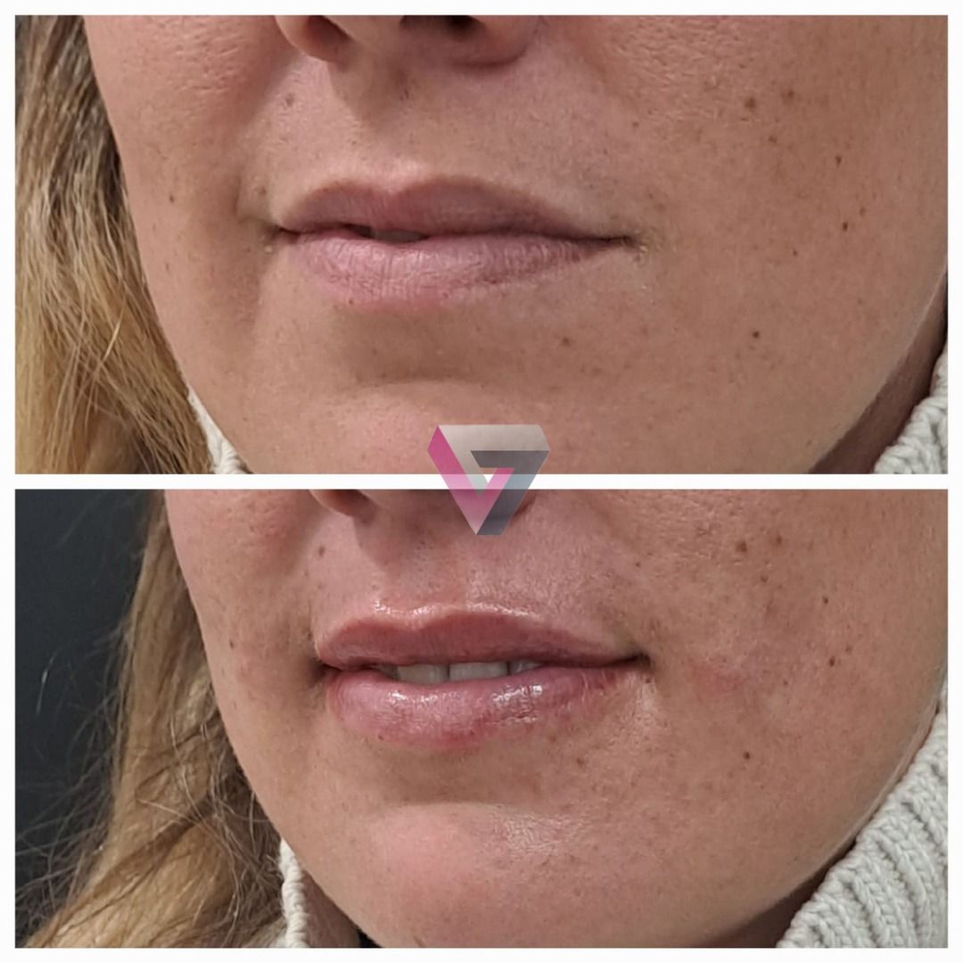 Victoria Trasmonte-89