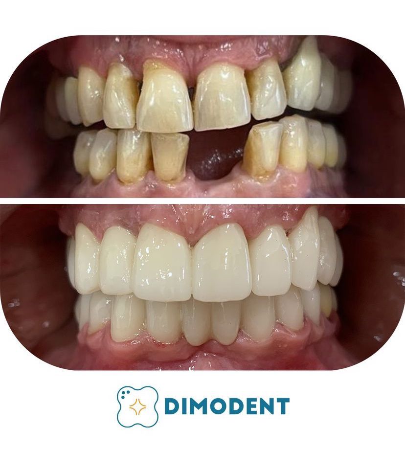 Marcello Di Monaco-12