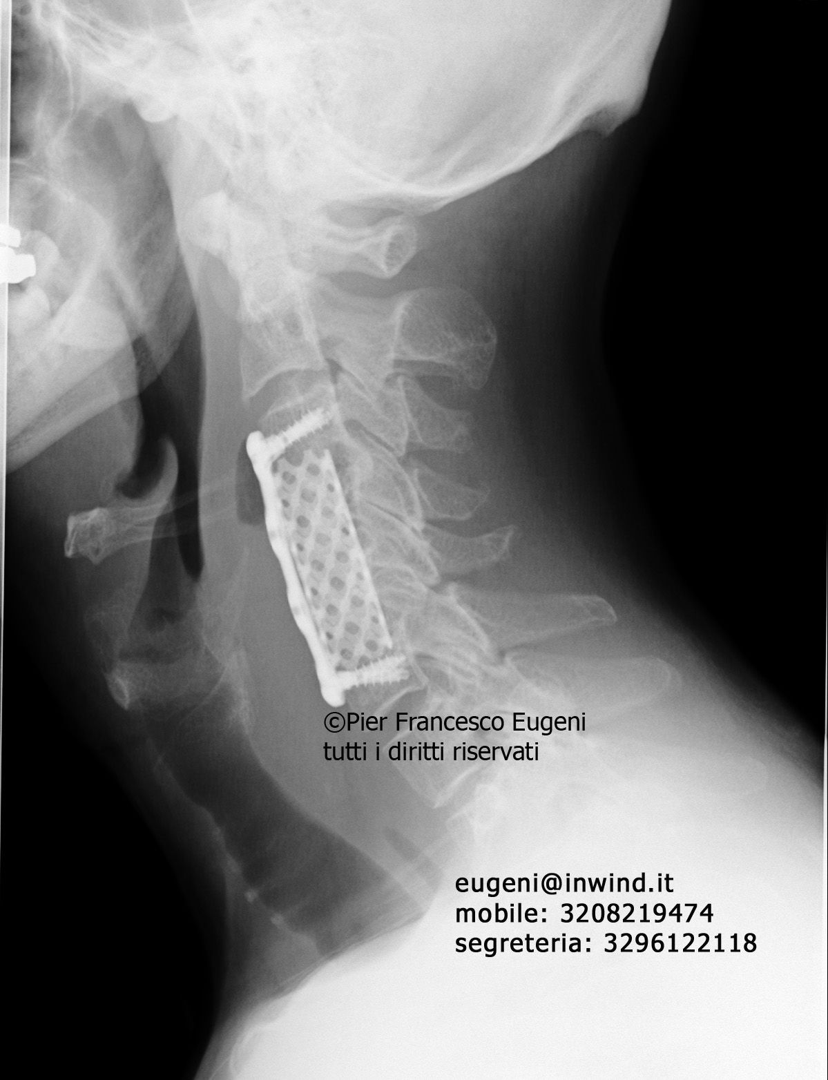 Pier Francesco Eugeni-0