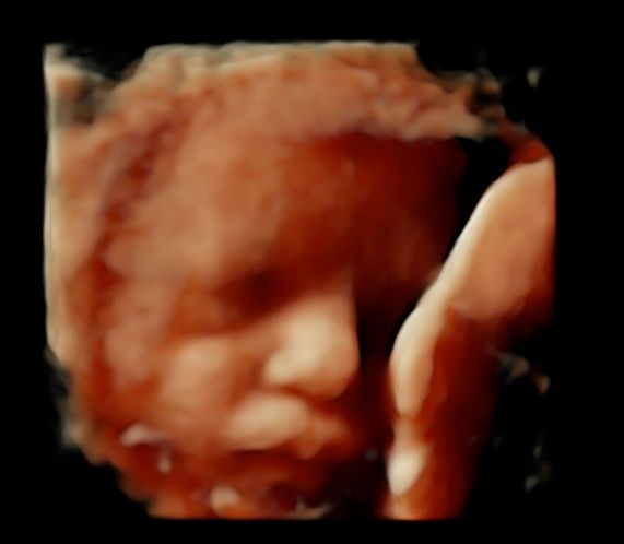 Tommaso Incandela-62