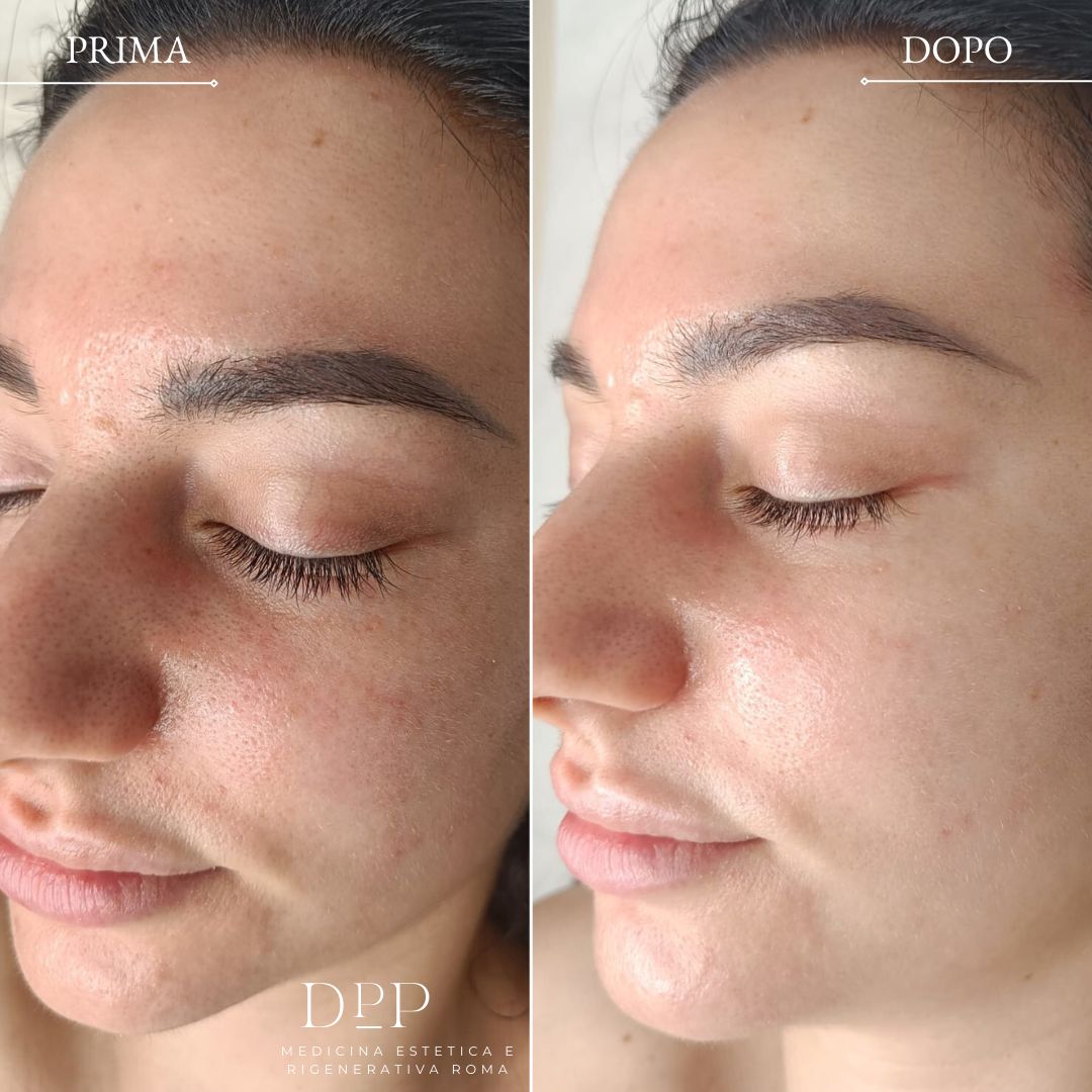 Davide Prosperi Porta-6