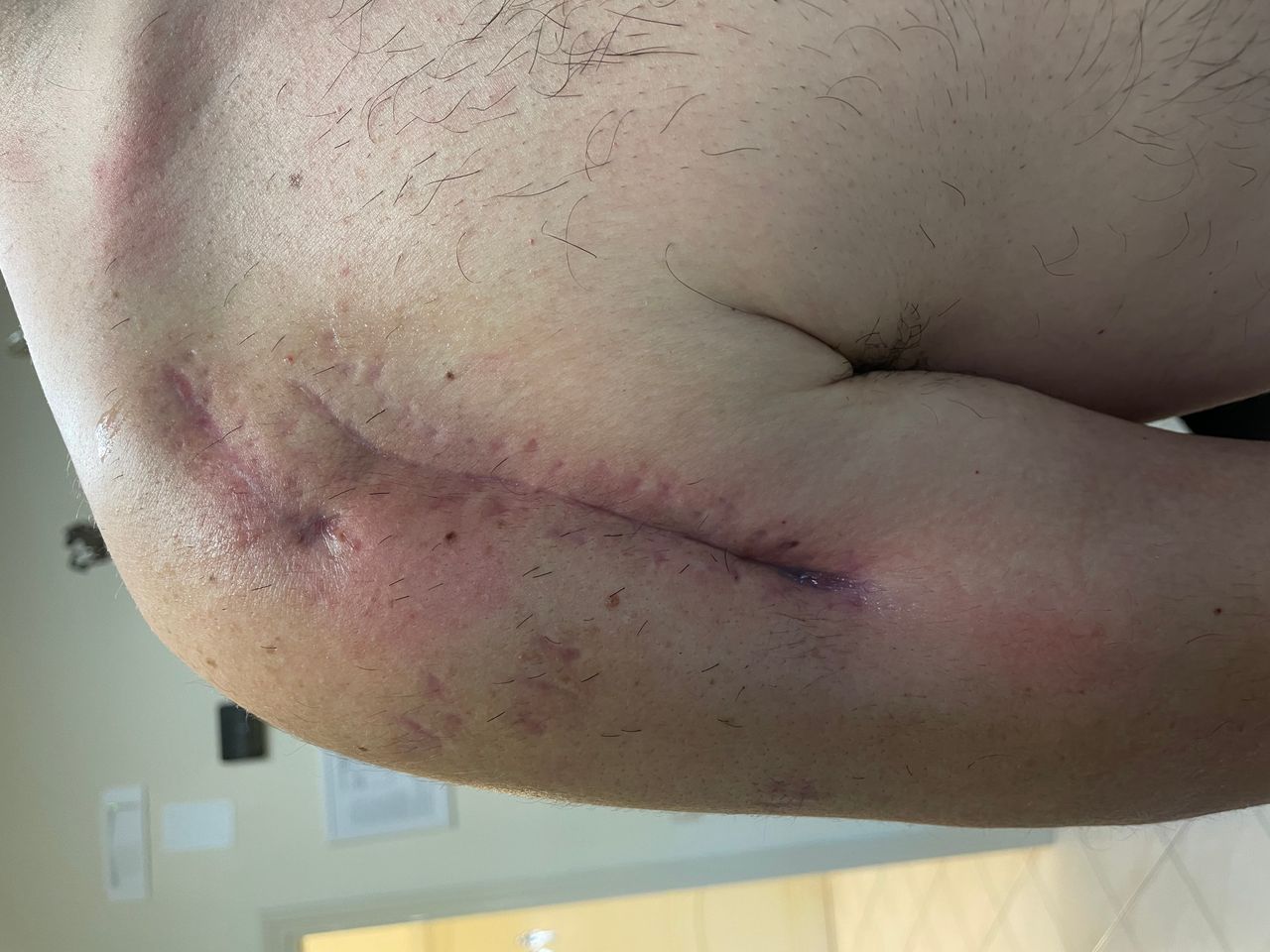 Giuseppe Lombardo-49