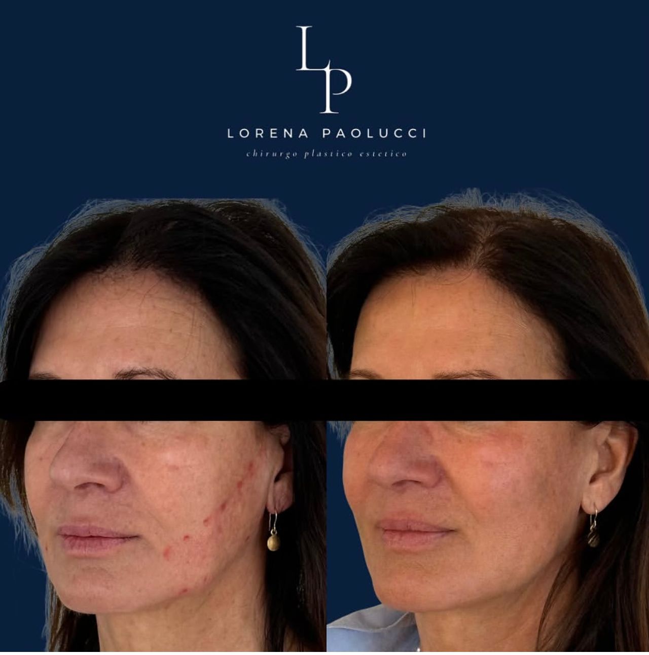 Lorena Paolucci-49