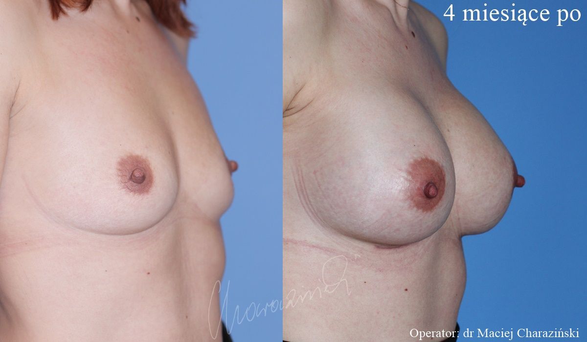 Maciej Charaziński-125