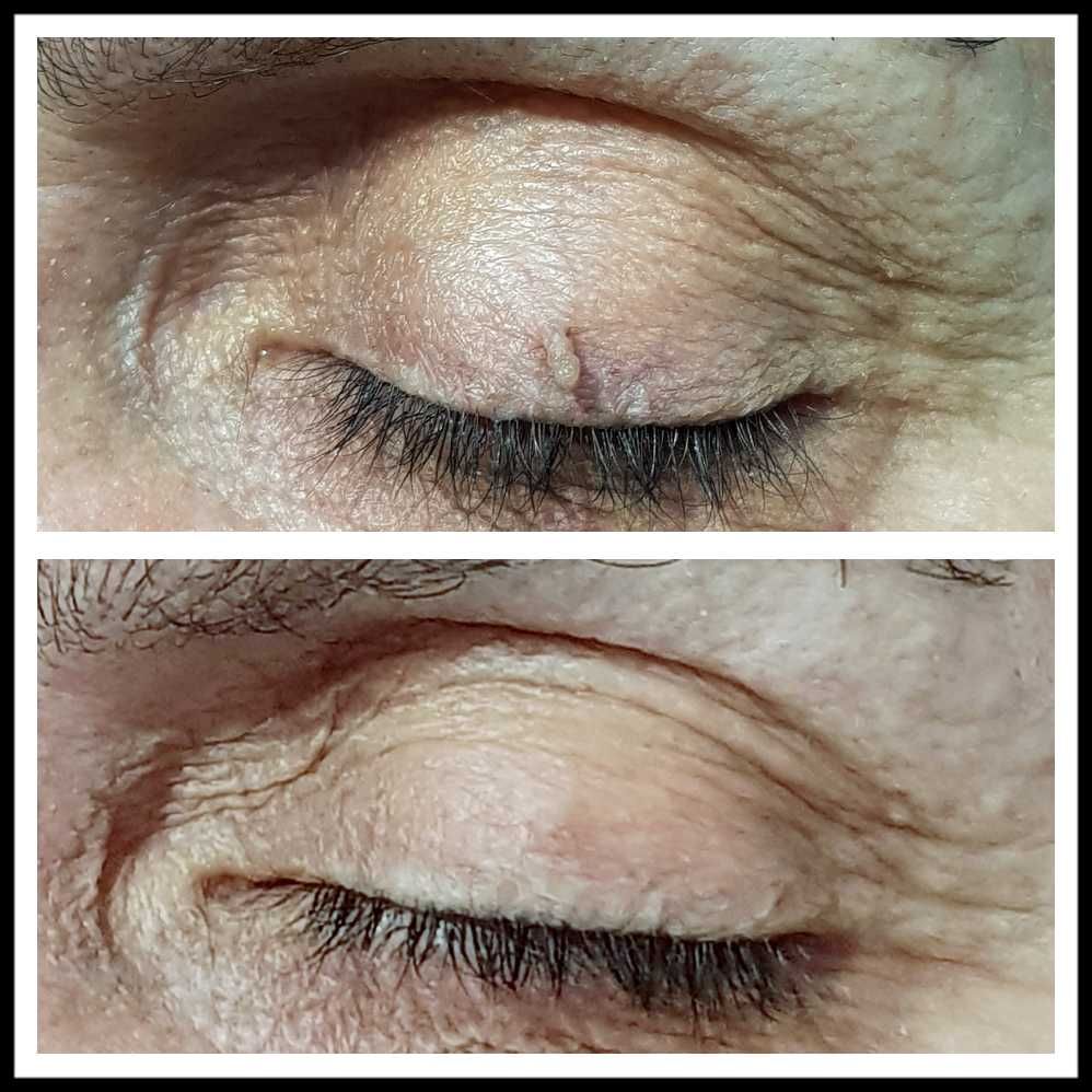 Rosalba Herrero Zerpa-374