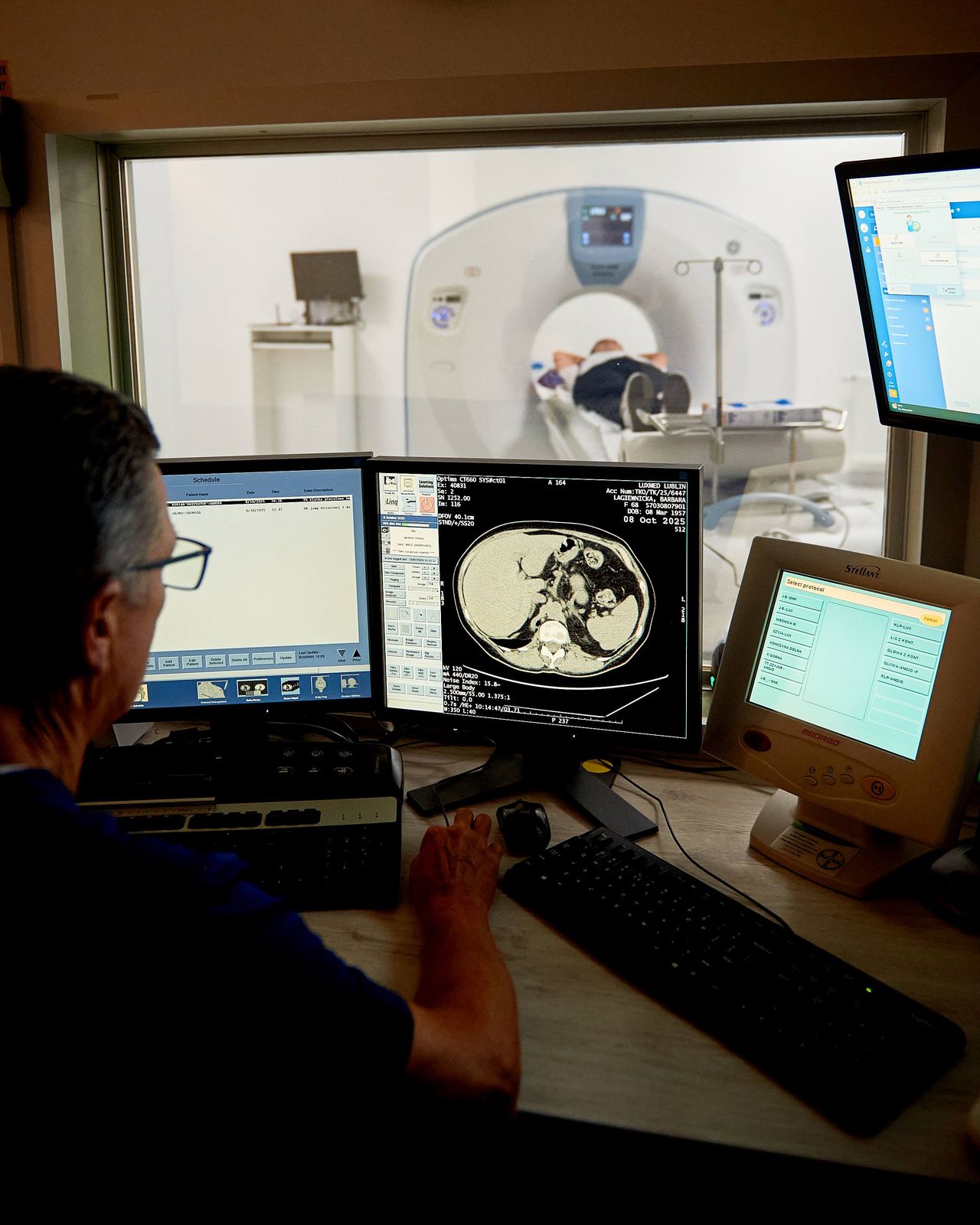 Tomografia Komputerowa  Luxmed Lublin Orkana-1