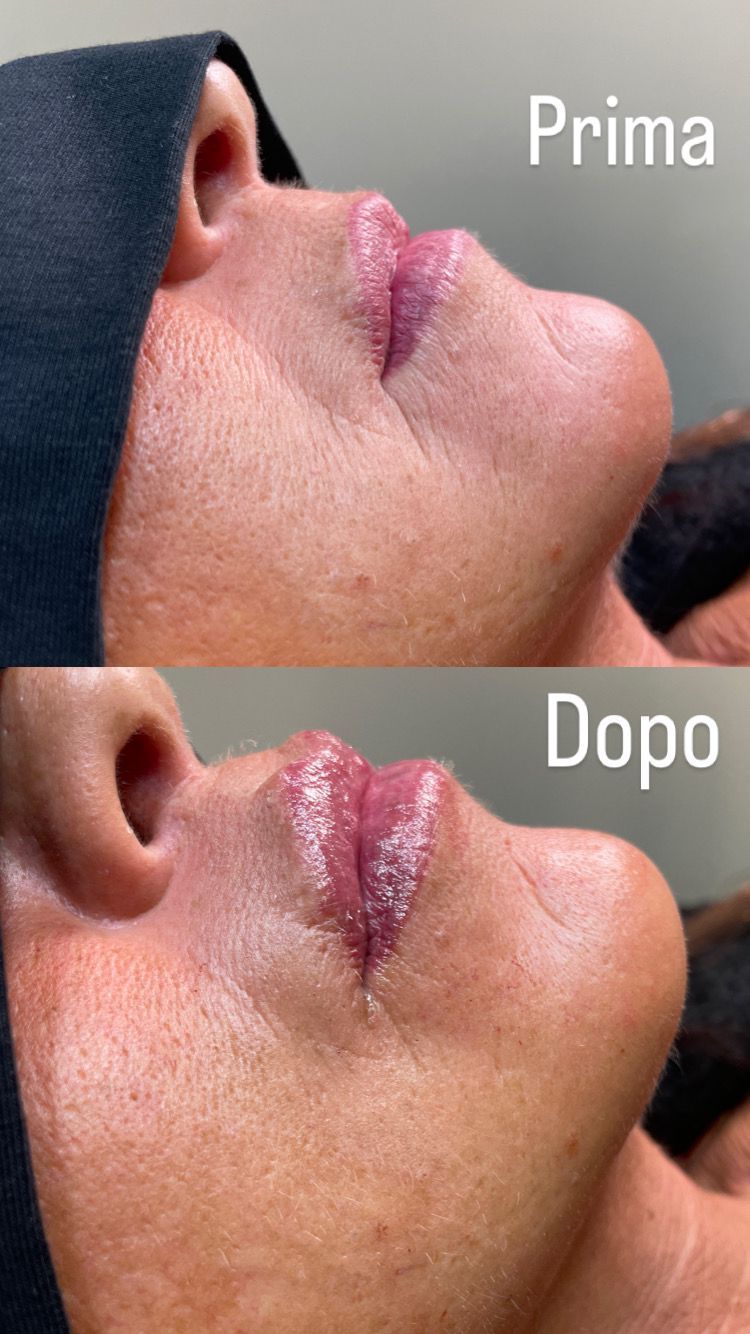 Alberto Alessandri-5