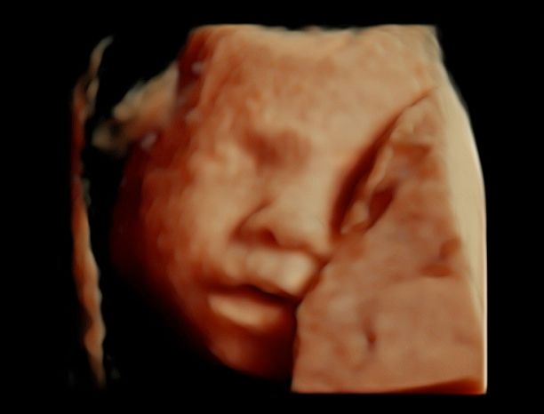 Tommaso Incandela-68