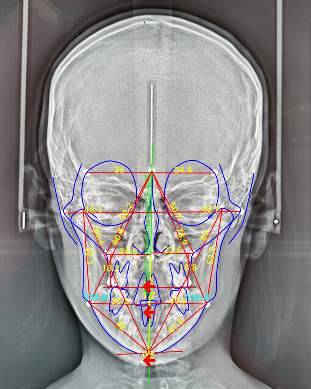 Giacinto Daniele Fiorenza-20