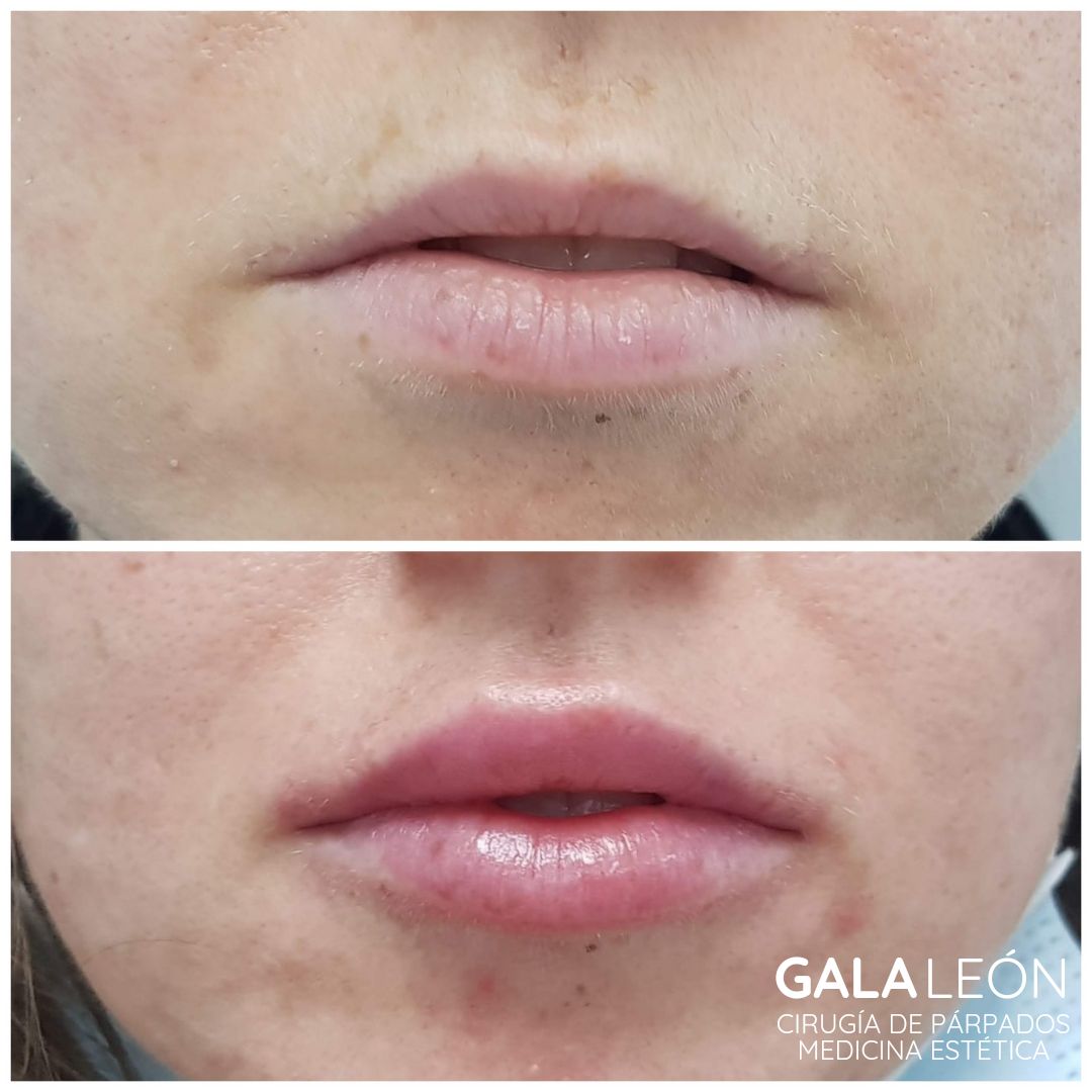 Gala P. Leon Salvatierra-6