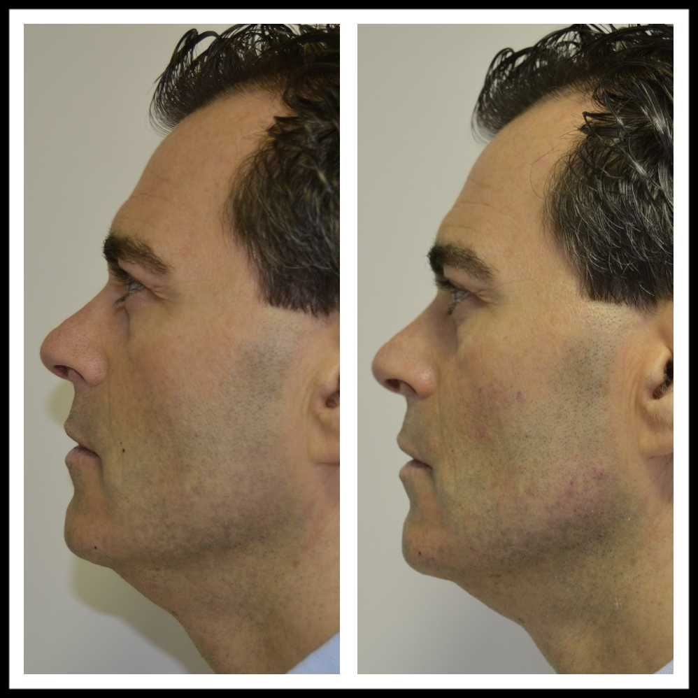 Rosalba Herrero Zerpa-330