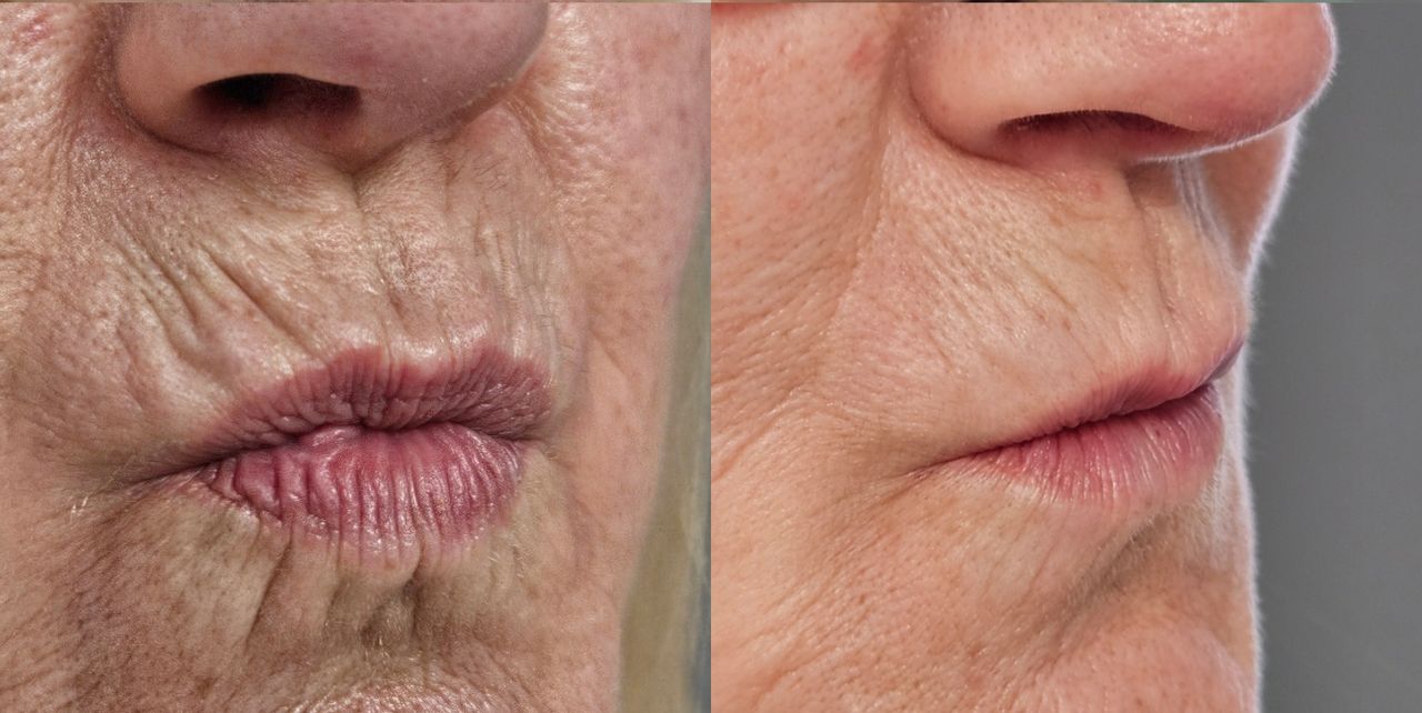 Rosalba Herrero Zerpa-22