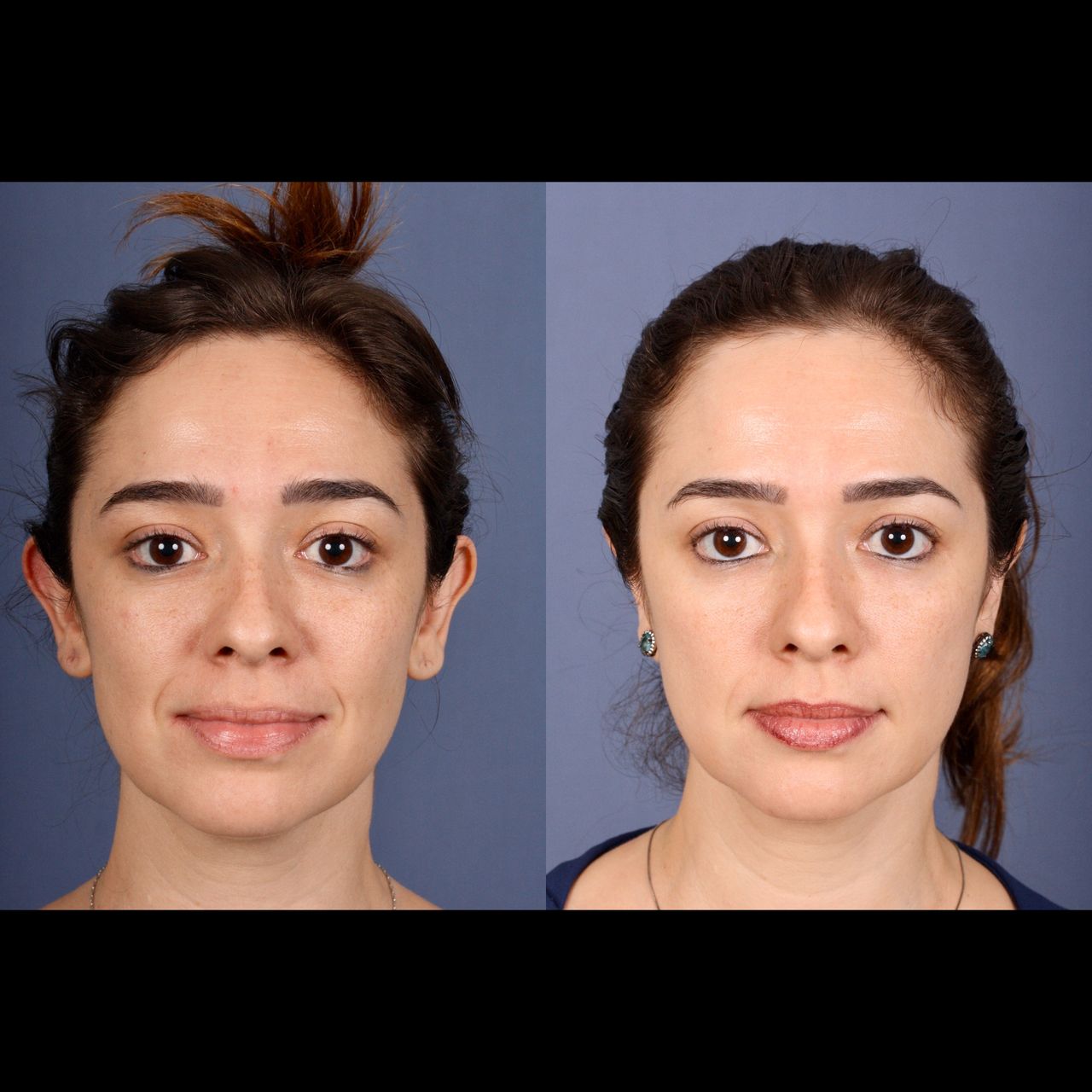 Alvaro Perez Villar-6