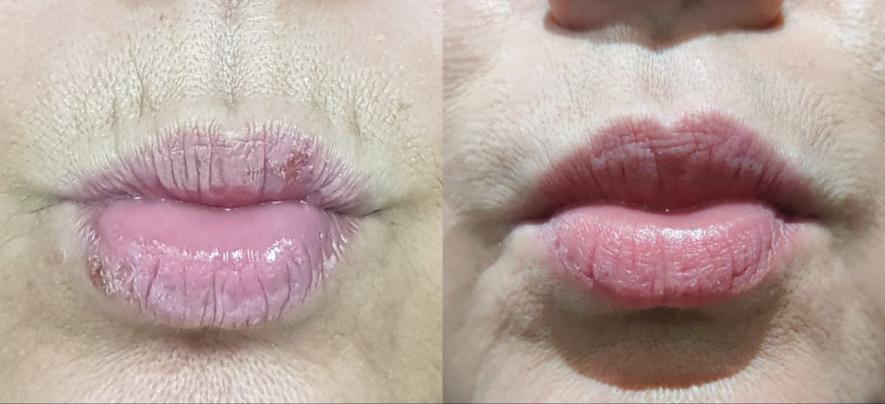 Rosalba Herrero Zerpa-64