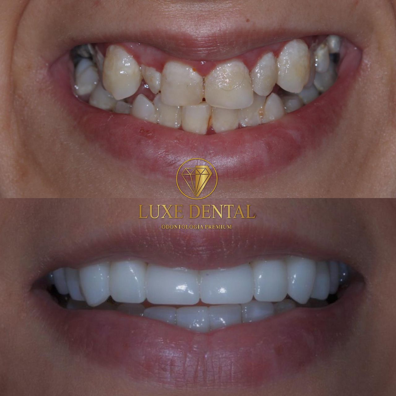 Ruben Patier Martin-2