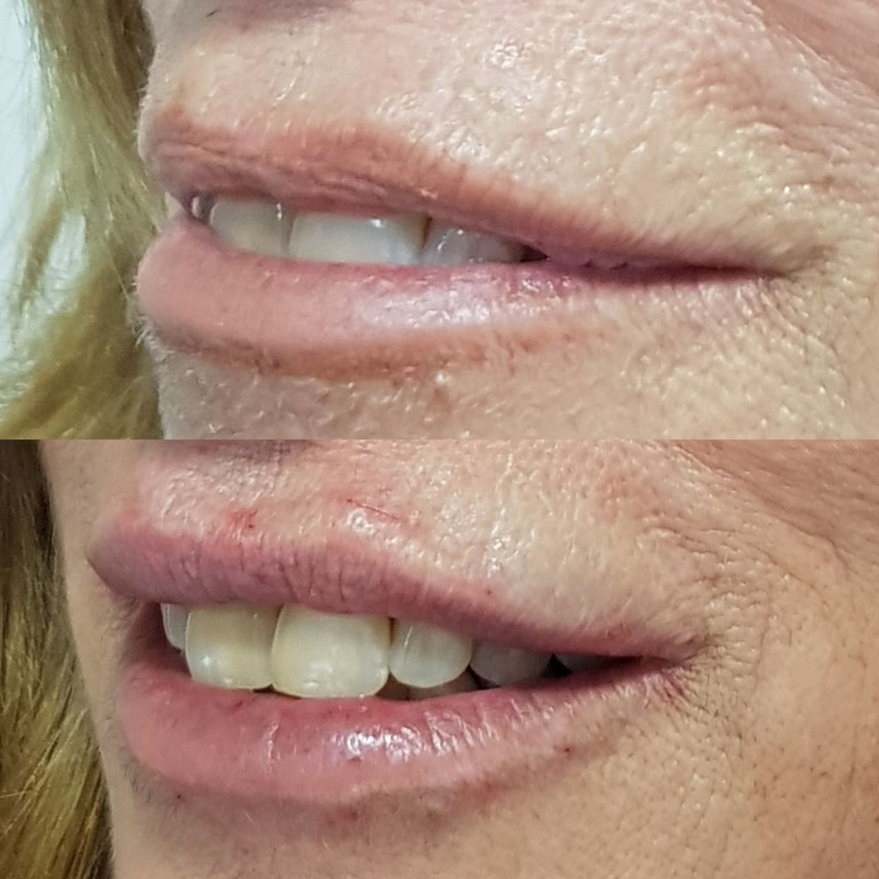 Rosalba Herrero Zerpa-282