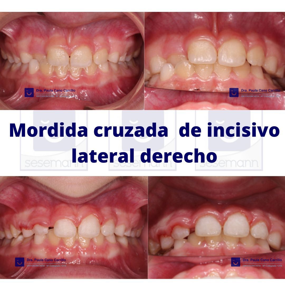 Paula Cano Carrillo-99