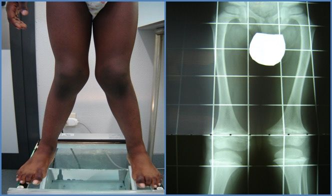 Giovanni Luigi Di Gennaro-8