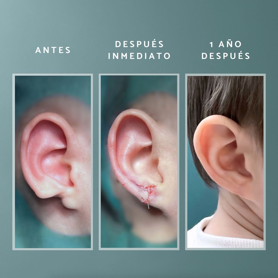 Concepción Lorca García-3