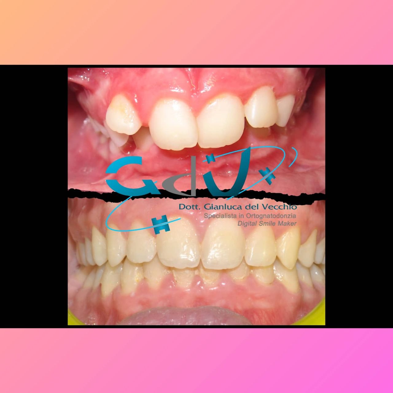 Gianluca Del Vecchio-160