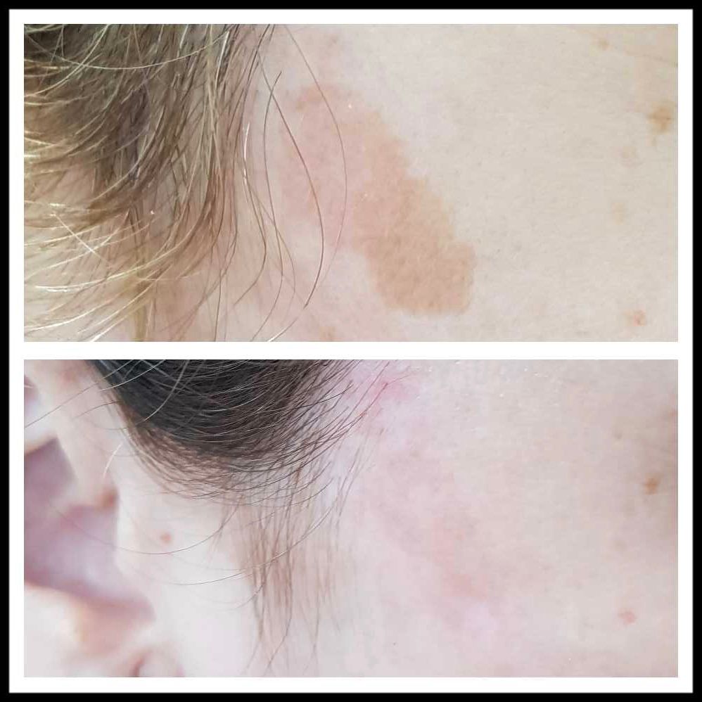 Rosalba Herrero Zerpa-323