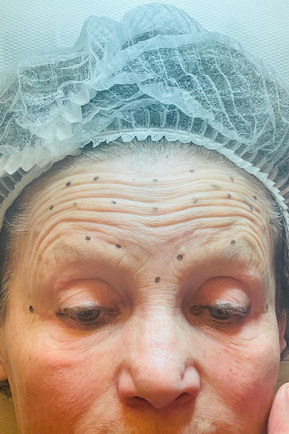 Alberto Alessandri-15