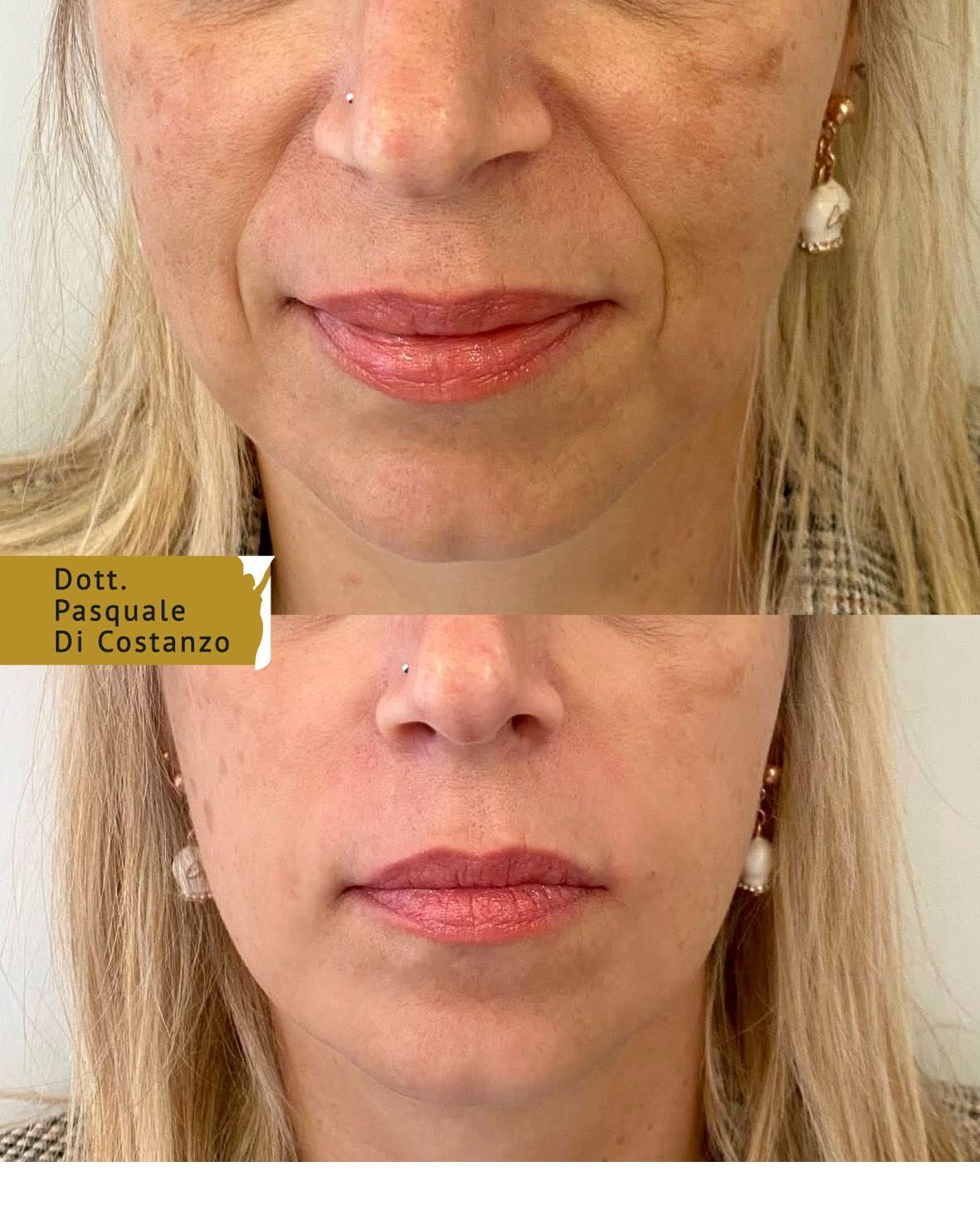 Pasquale Di Costanzo-44