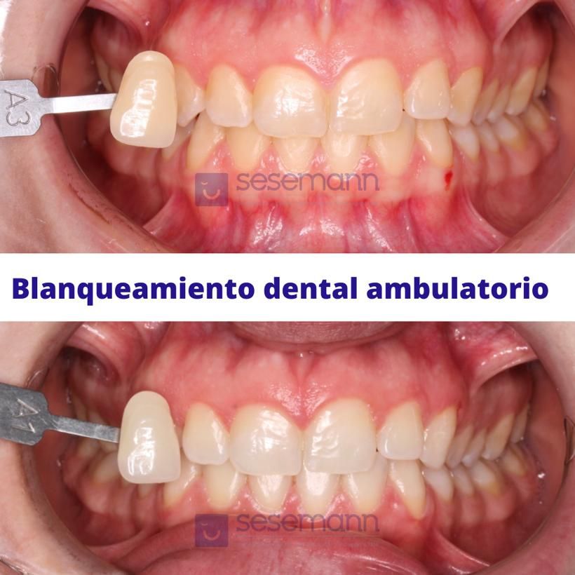 Paula Cano Carrillo-68