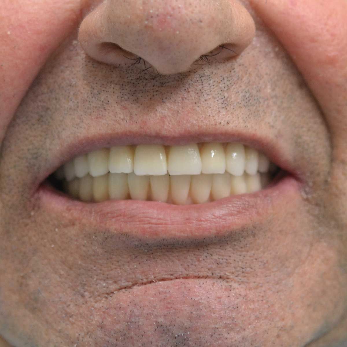 Gianluigi Bittante-70