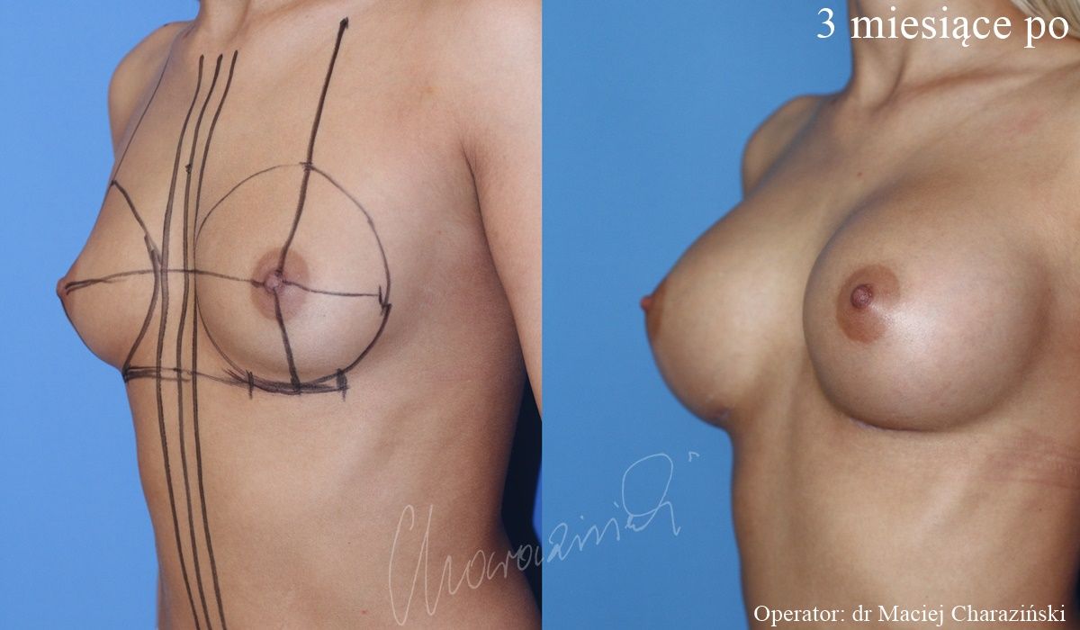 Maciej Charaziński-110