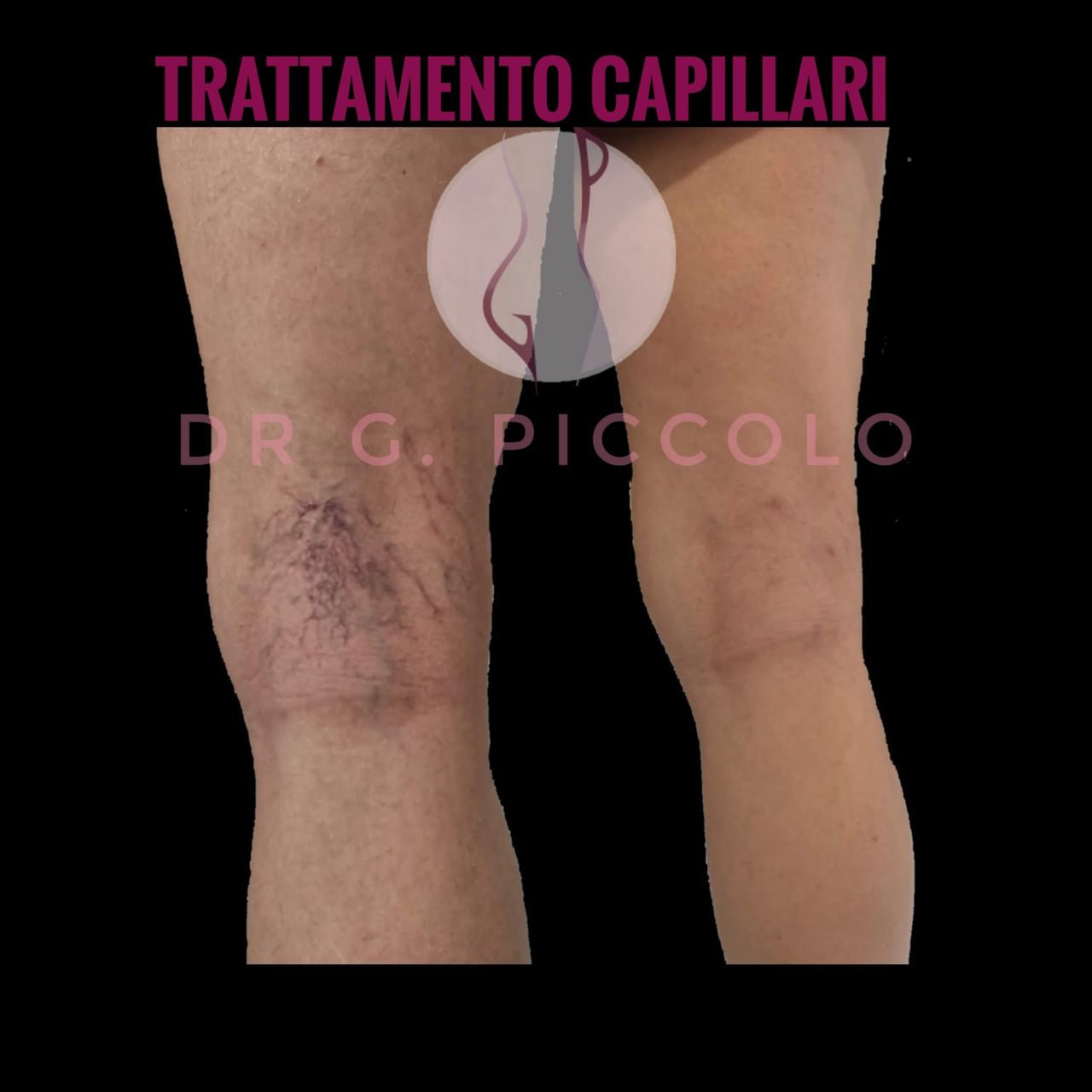 Giuseppina Piccolo-41