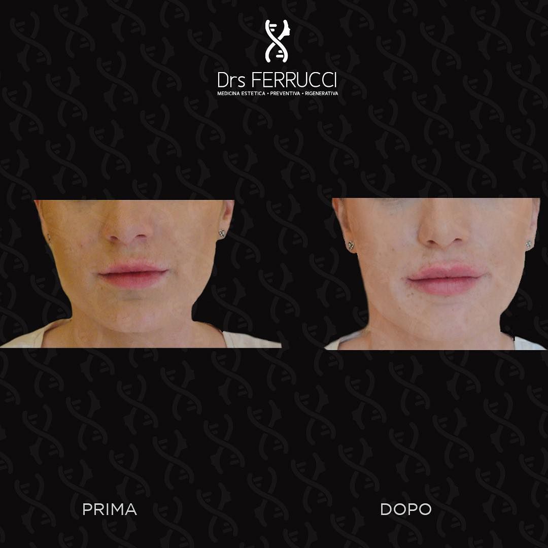 Giuseppe Ferrucci-30