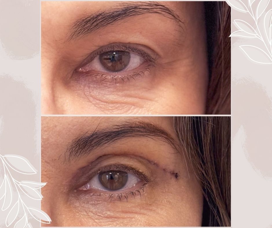 Piotr Florczuk-Dąbek-14