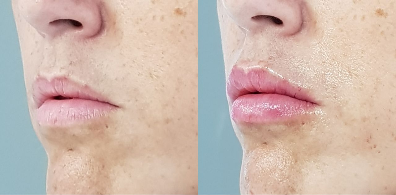 Rosalba Herrero Zerpa-162