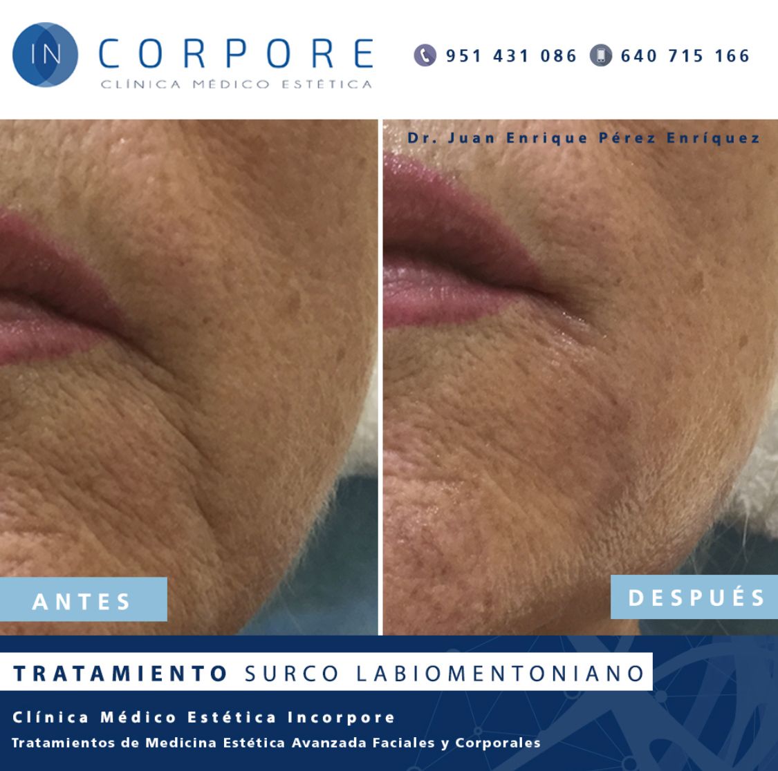 Juan Enrique Pérez Enríquez-35