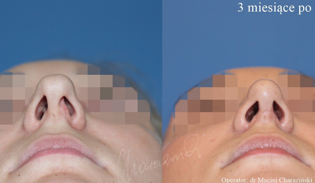 Maciej Charaziński-54