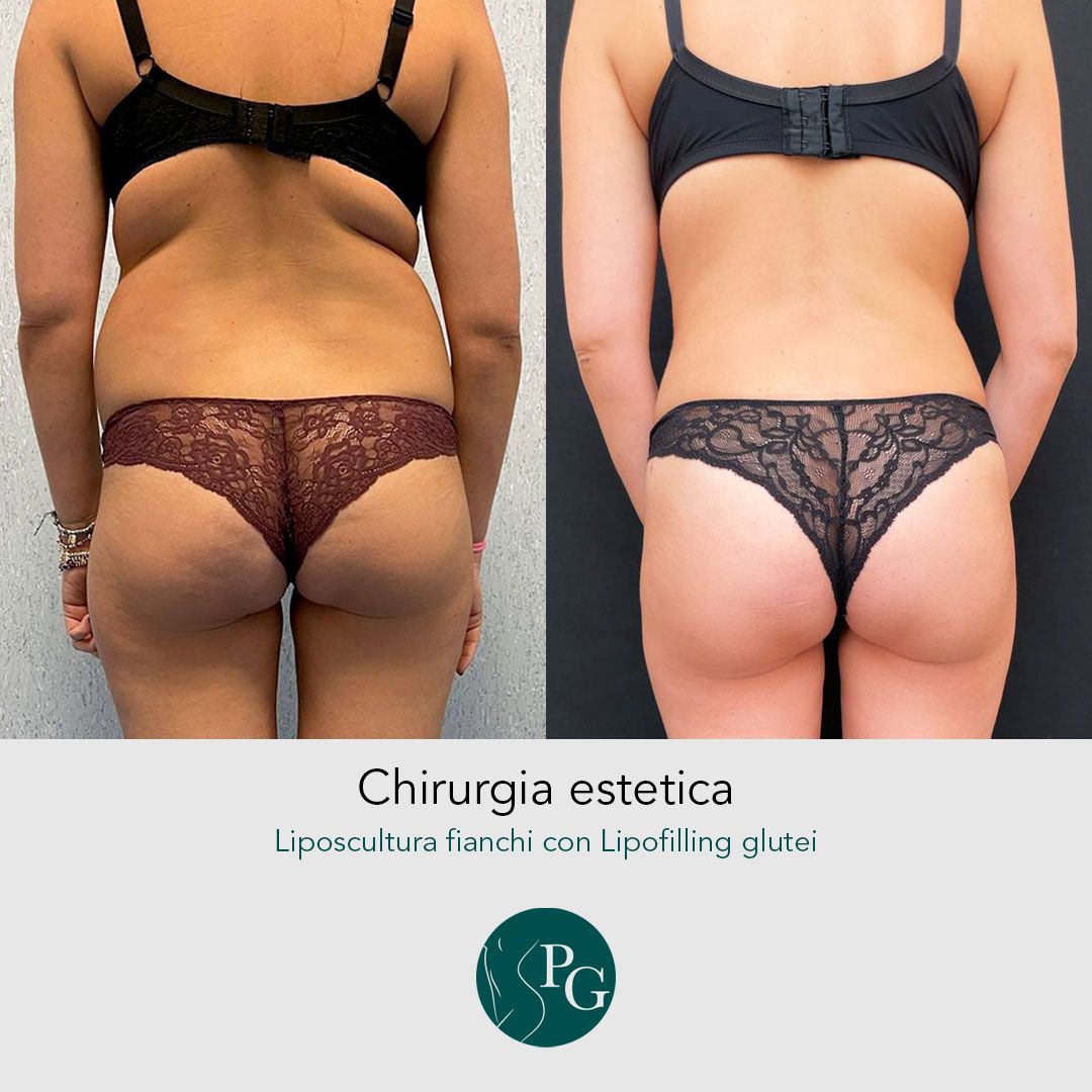 Pasquale Graziano-11