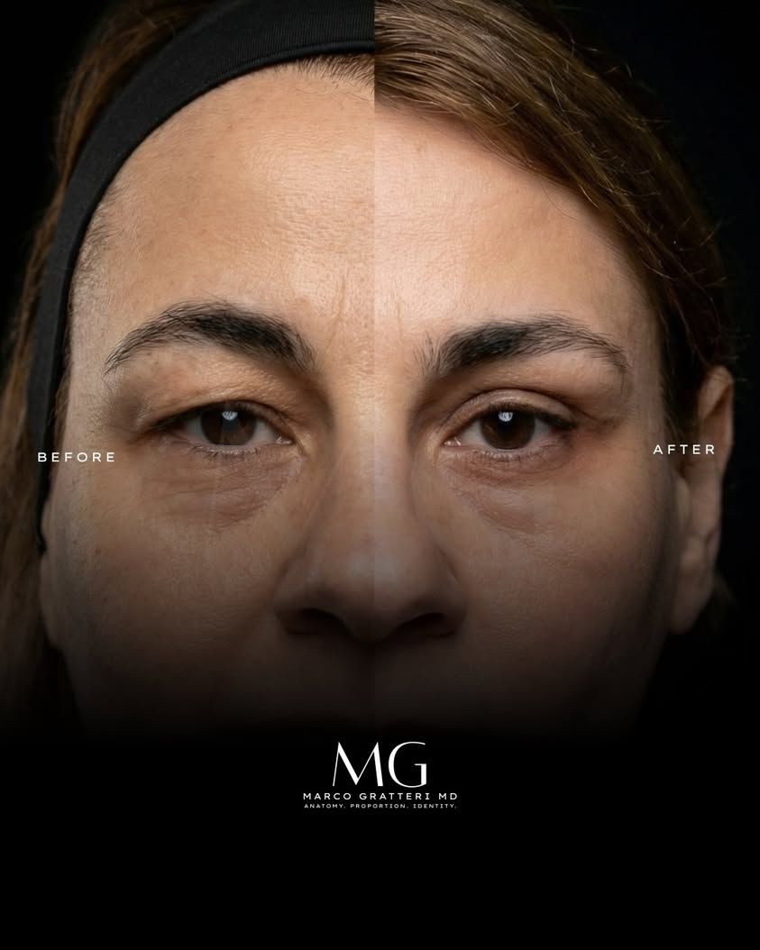 Marco Gratteri-0