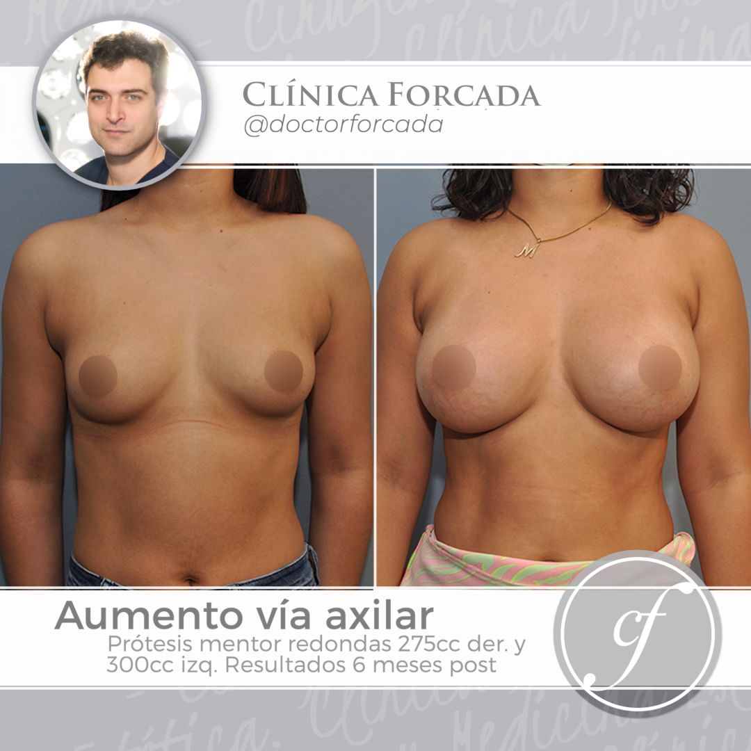 Eduardo Forcada Melero-3