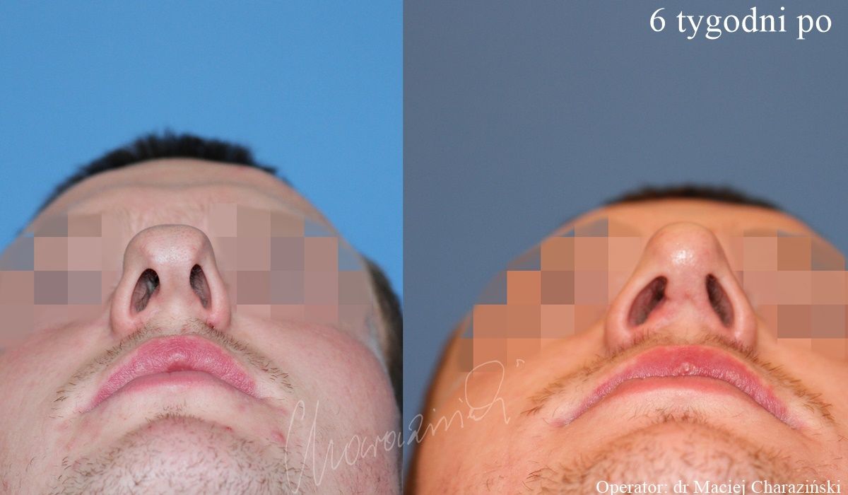 Maciej Charaziński-49